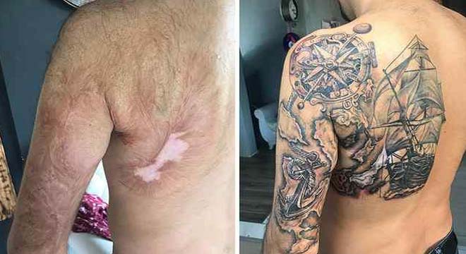 Imágenes de tatuajes usados para tapar cicatrices. 6